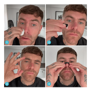 Nasoflex® – Dilatador Nasal Anti-Ronco & Performance Respiratória