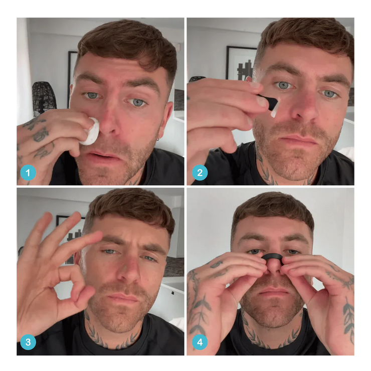 Nasoflex® – Dilatador Nasal Anti-Ronco & Performance Respiratória