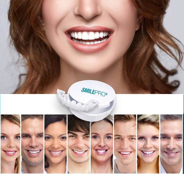 SMILEPRO® – Carillas para Dientes | Oferta 2 por 1